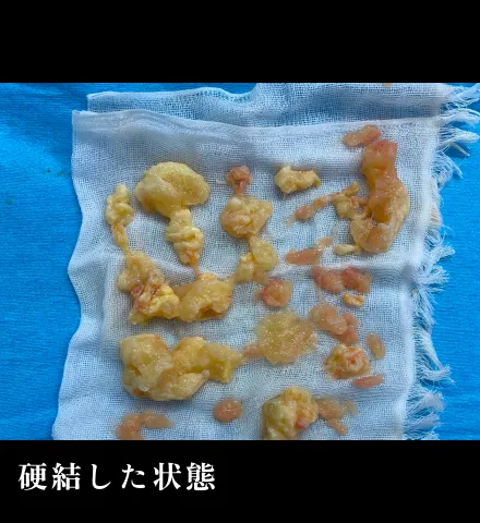 硬結した状態